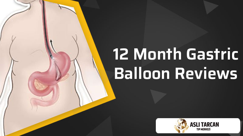 12 Month Gastric Balloon Reviews