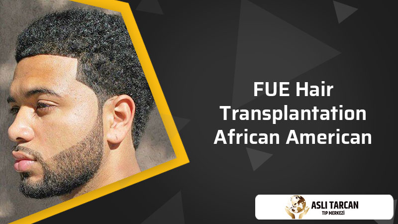FUE Hair Transplantation African American
