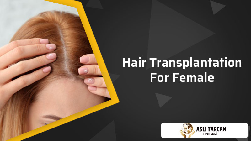 Hair Transplantation For Female