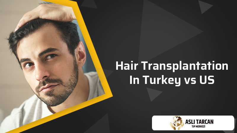 Hair Transplantation In Turkey vs US