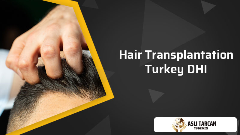 Hair Transplantation Turkey DHI