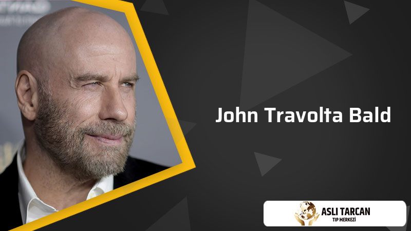 John Travolta Bald