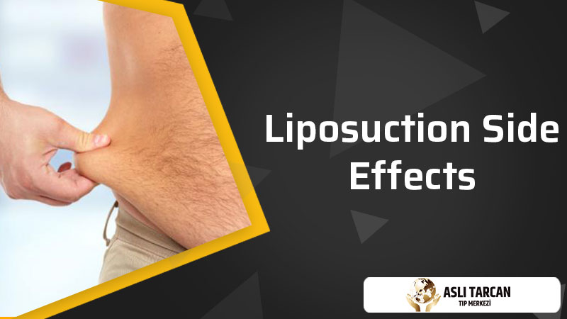 Liposuction Side Effects