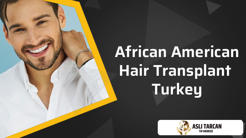 African American Hair Transplant Turkey