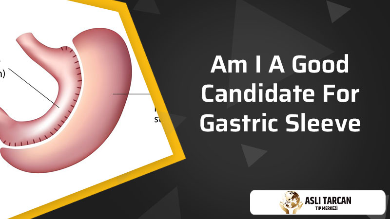 Am I A Good Candidate For Gastric Sleeve