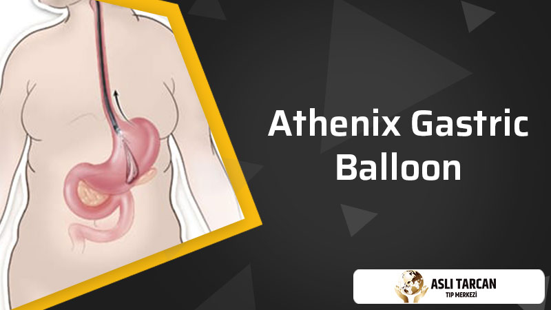 Athenix Gastric Balloon