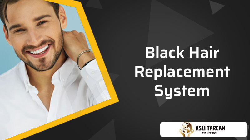 Black Hair Replacement System