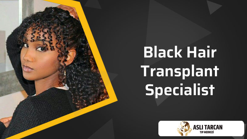 Black Hair Transplant Specialist