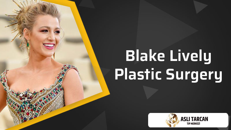 Blake Lively Plastic Surgery