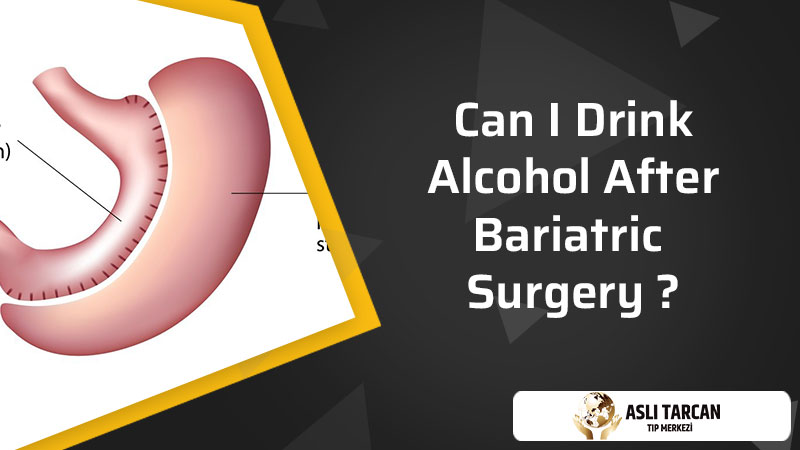 Can I Drink Alcohol After Bariatric Surgery