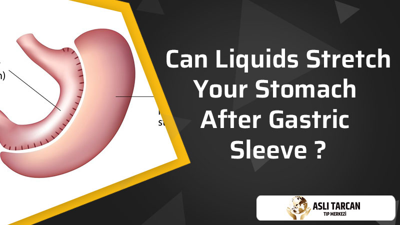 Can Liquids Stretch Your Stomach After Gastric Sleeve