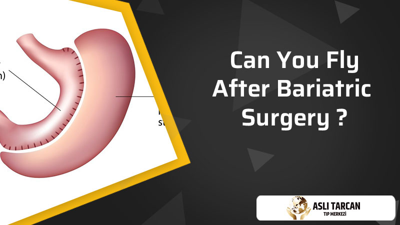 Can You Fly After Bariatric Surgery