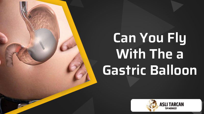 Can You Fly With The a Gastric Balloon