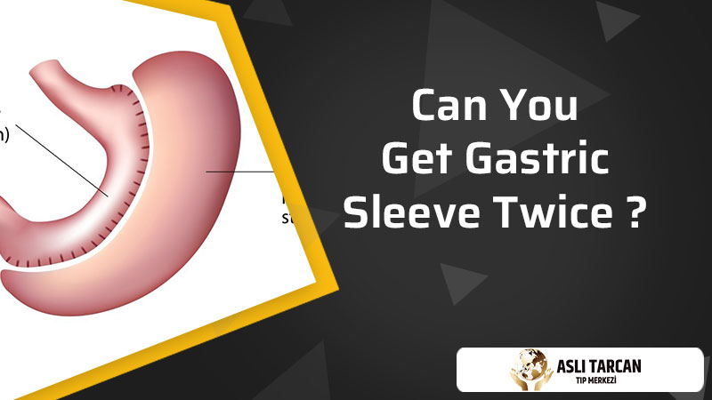 Can You Get Gastric Sleeve Twice