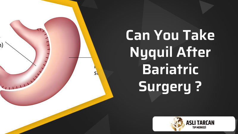 Can You Take Nyquil After Bariatric Surgery