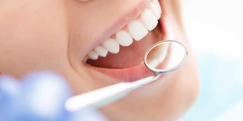 Cost Of Full Mouth Dental Implants Near Me