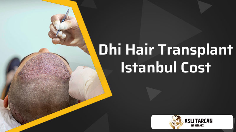 DHI Hair Transplant Istanbul Cost