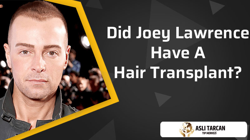 Did Joey Lawrence Have A Hair Transplant? | Asli Tarcan Clinic