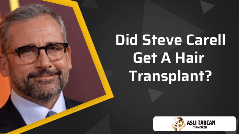 Did Steve Carell Get A Hair Transplant?