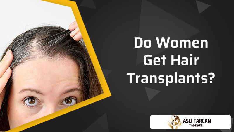 Do Women Get Hair Transplants?