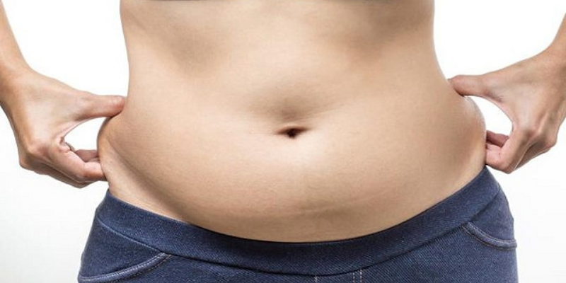 Do You Have To Have Plastic Surgery After Extreeme Weightloss?