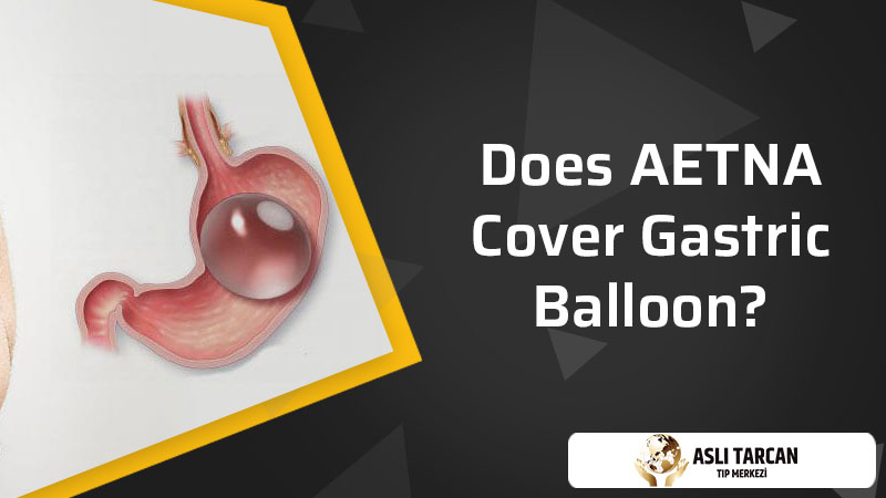 Does AETNA cover gastric balloon