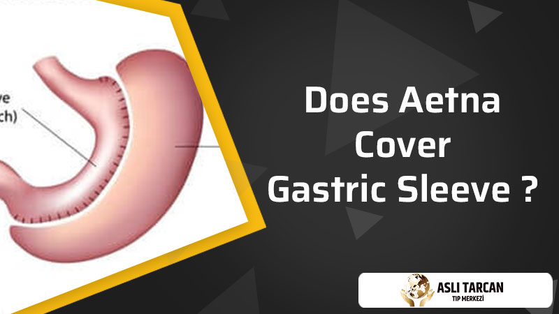 Does Aetna Cover Gastric Sleeve