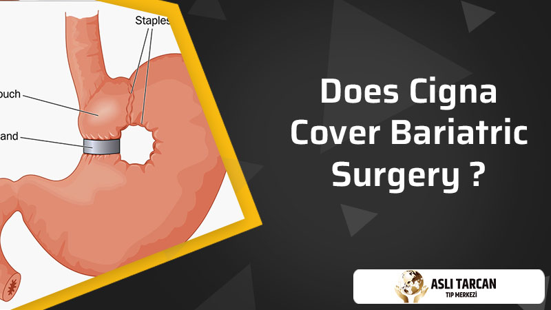 Does cigna cover lap band surgery accenture consulting development program reddit