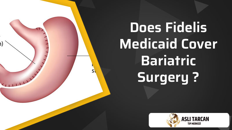 Does Fidelis Medicaid Cover Bariatric Surgery