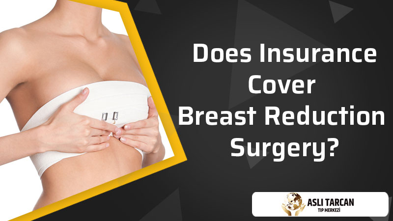 Does Insurance Cover Breast Reduction Surgery?
