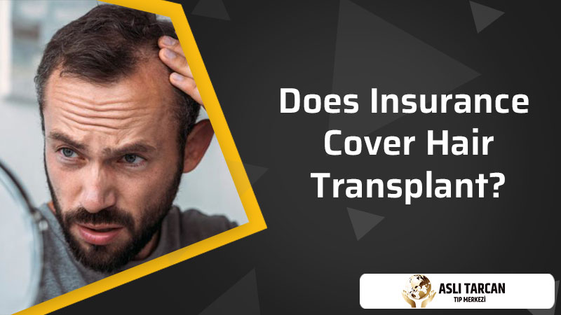 Does Insurance Cover Hair Transplant?