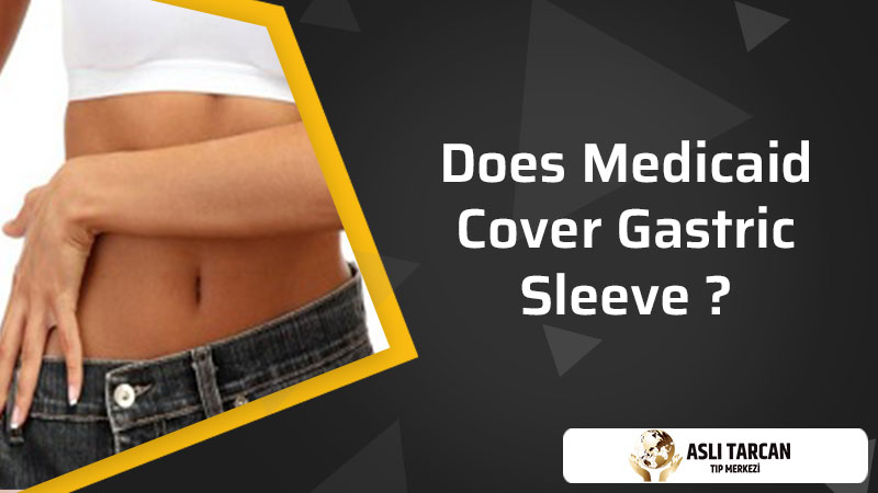 Does Medicaid Cover Gastric Sleeve