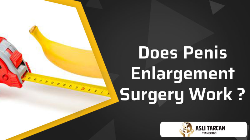 Does Penis Enlargement Surgery Work?