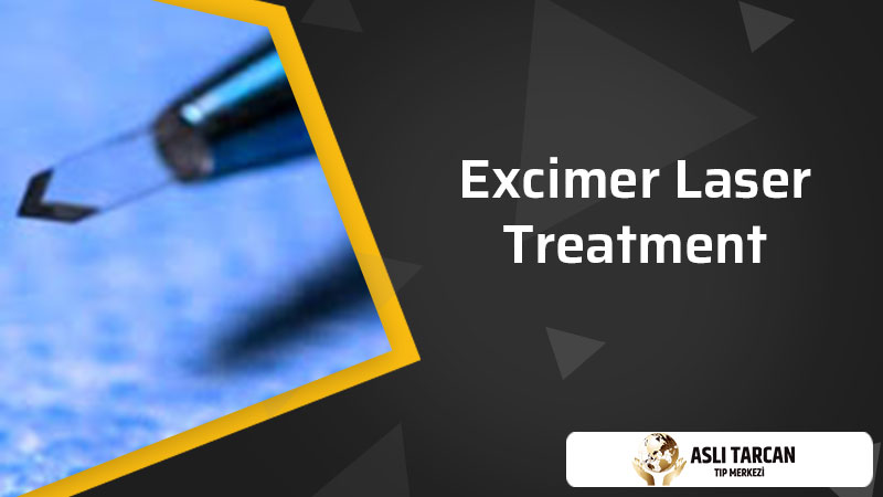 Excimer Laser Treatment
