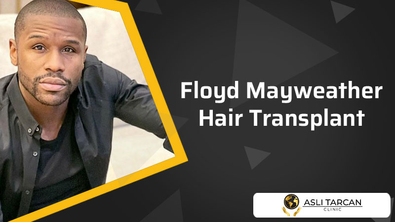 Floyd Mayweather Hair Transplant