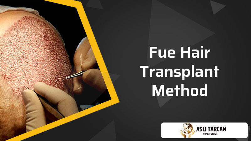 FUE hair transplantation method