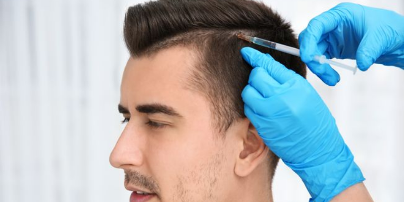 Fue Hair Transplant Results