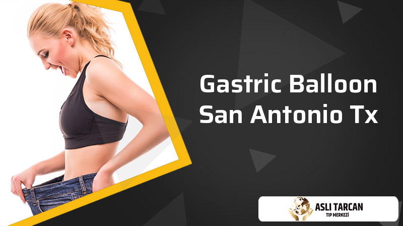 Gastric Balloon San Antonio Tx