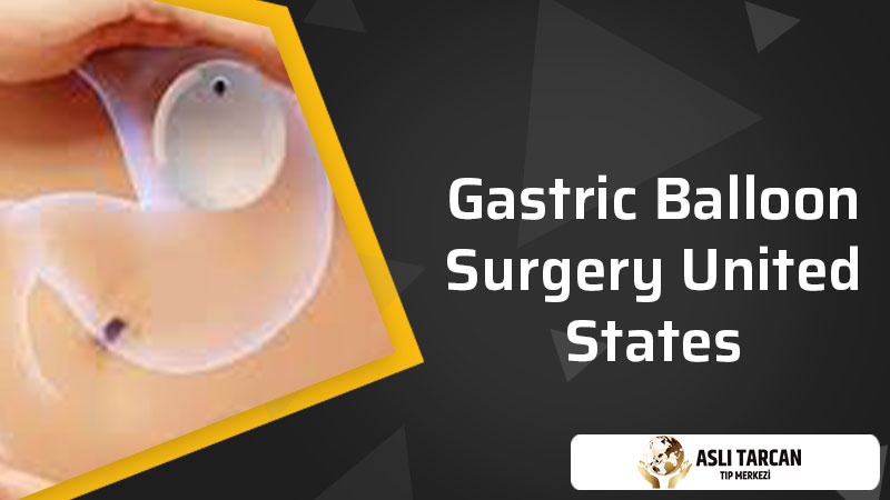 Gastric Balloon Surgery United States