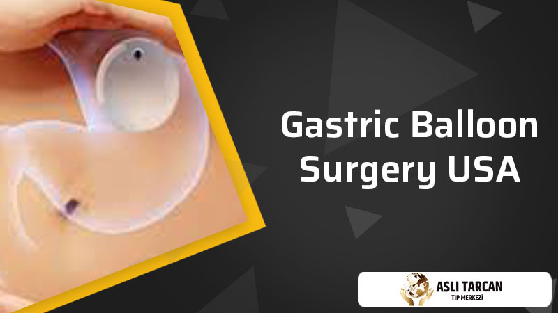 Gastric balloon surgery USA