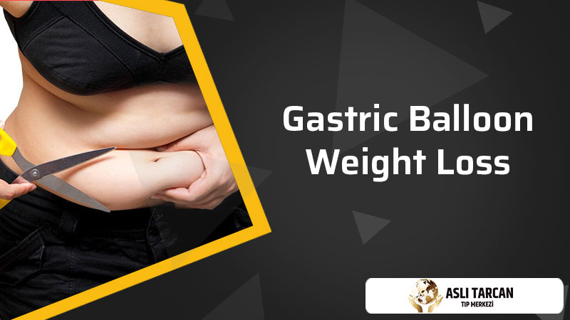 Gastric Balloon Weight Loss