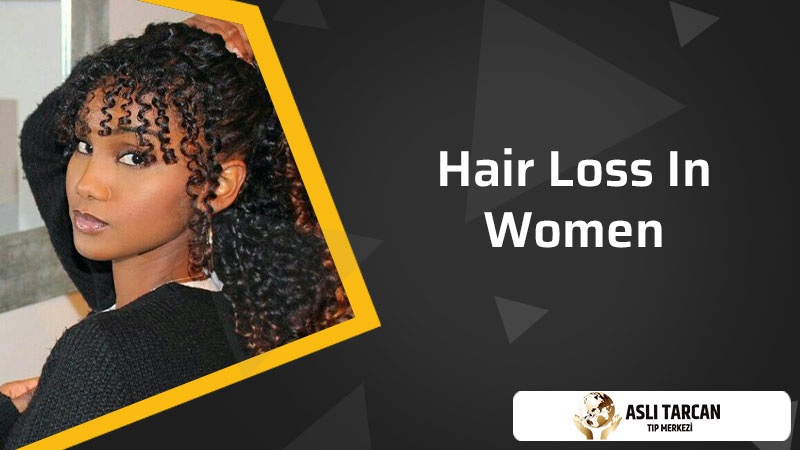 Hair Loss In Women