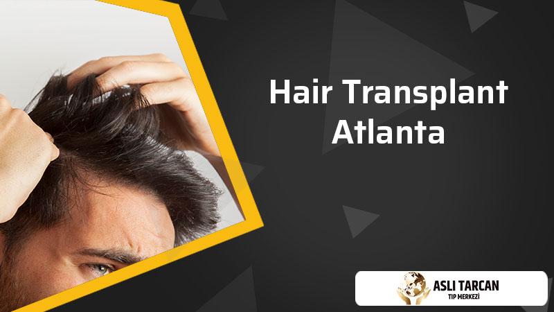 Hair Transplant Atlanta