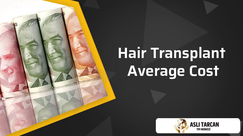 Hair Transplant average Cost