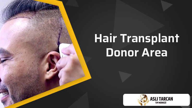 Hair Transplant Donor Area