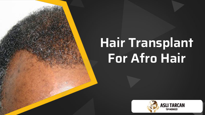 Hair transplant for Afro hair