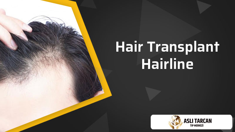 Hair Transplant Hairline | Asli Tarcan Clinic