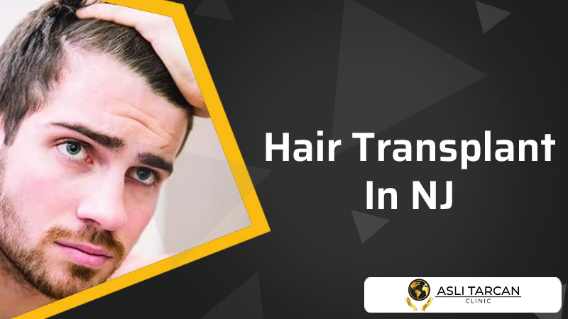 Hair Transplant In NJ