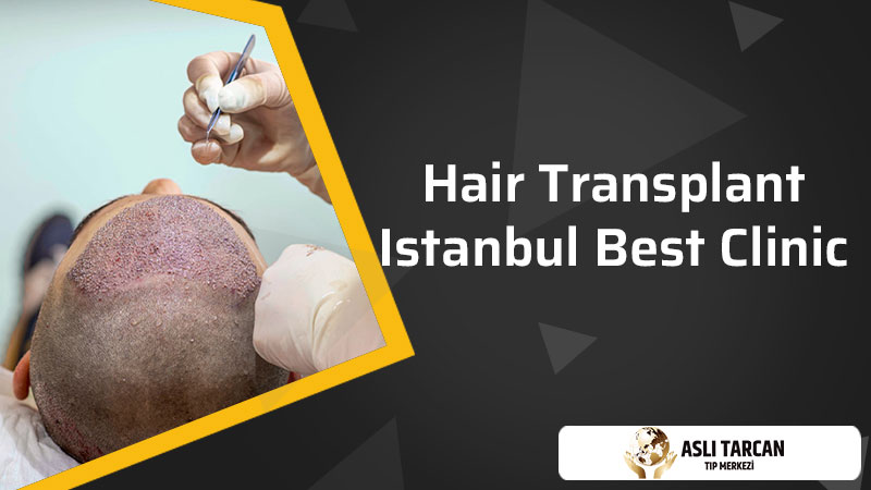 Hair Transplant Istanbul Best Clinic | Asli Tarcan Clinic