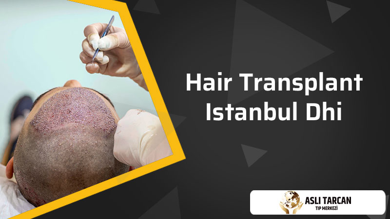 Hair Transplant Istanbul DHI